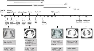 Frontiers Metagenomic Analysis Identified Stenotrophomonas   475498 Thumb 400 